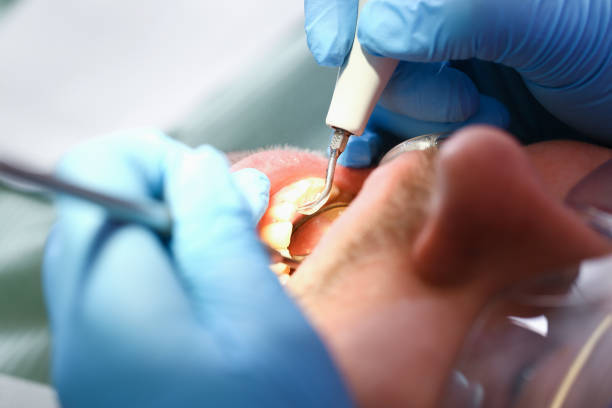 Best Broken or Chipped Tooth Repair in Charleston, WV