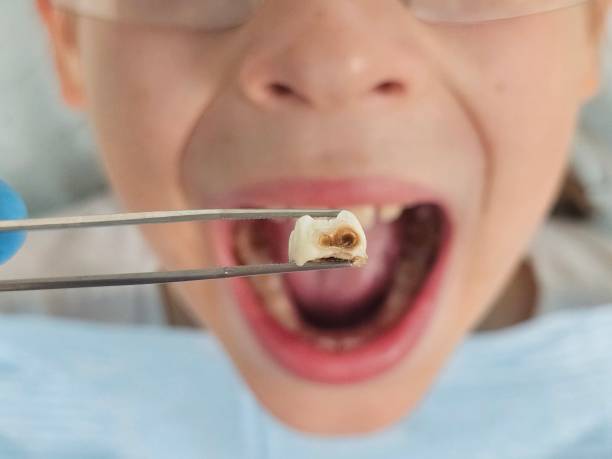 Best Emergency Pediatric Dental Care in Charleston, WV