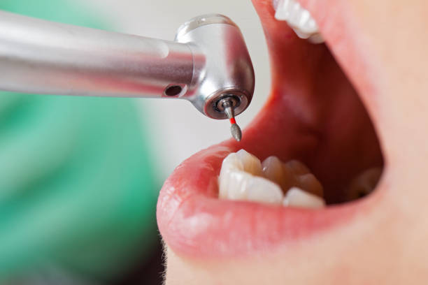 Best Emergency Dental Care for Sports Injuries in Charleston, WV